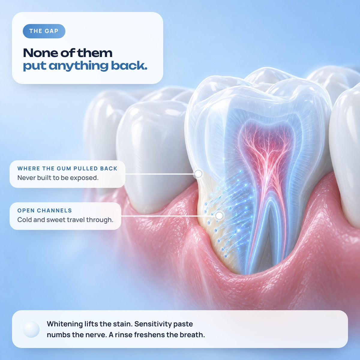 None of them put anything back: the exposed root surface under receding gum