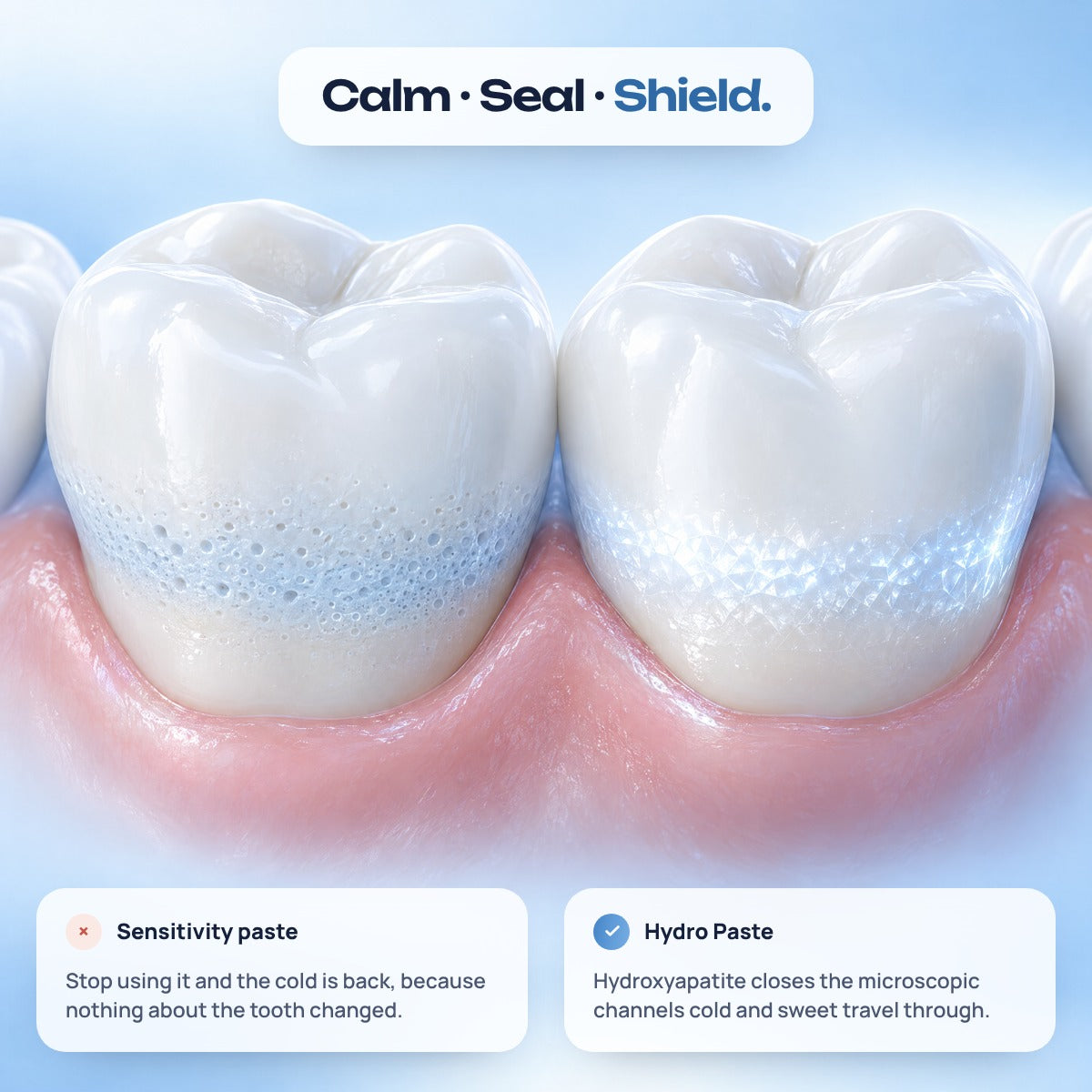 Calm, seal, shield: hydroxyapatite sealing the enamel at the gum line