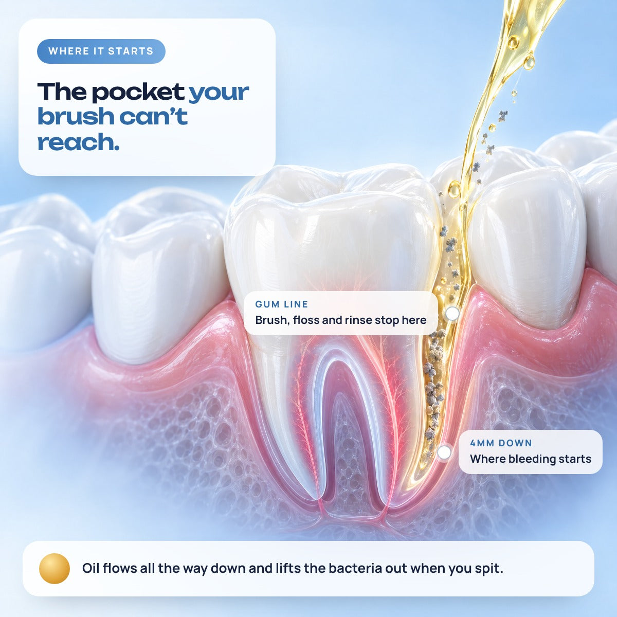 The pocket your brush can not reach, between gum and tooth
